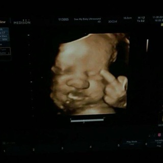 RUN AWAY🫵🏽🧳